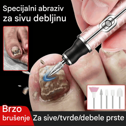 💅👍Električna turpija za nokte za liječenje onihomikoze